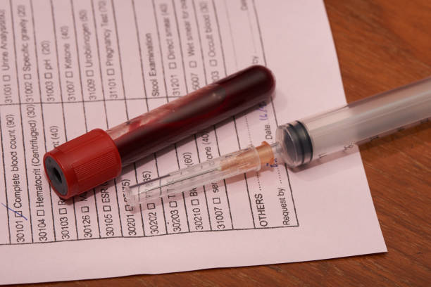 istock Syringe and blood sample in test tube 1302388848