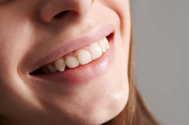 istock Beautiful female smile with white straight teeth. 1302418185