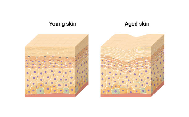 векторная иллюстрация молодой и пожилой кожи - melanocyte stock illustrations