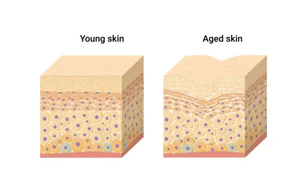 Vector illustration of Vector illustration of young and aged skin