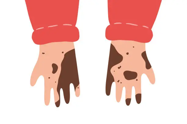 Vector illustration of Dirty unwashed hands. Isolated vector illustration in flat style