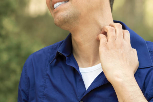 man suffering itching scratching neck Close-up of man suffering itching scratching neck standing outdoors in a park bug bite photos stock pictures, royalty-free photos & images