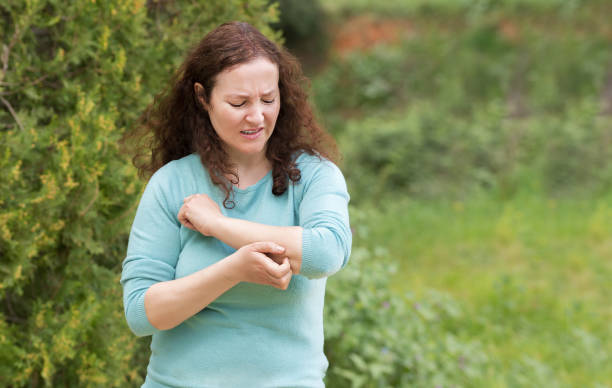 Woman scratching her arm Woman scratching arm because it stings in a park with copy space bug bite photos stock pictures, royalty-free photos & images