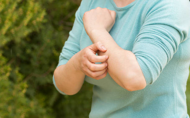 istock woman scratching her arm 1302799134