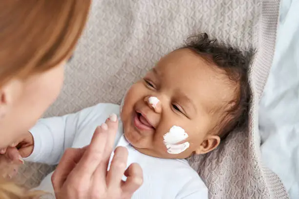 Photo of Caucasian mother applying healthy skin care moisturizing cream on cute adorable funny african american baby girl daughter face. Skincare lotion for infant pediatric diathesis treatment concept.