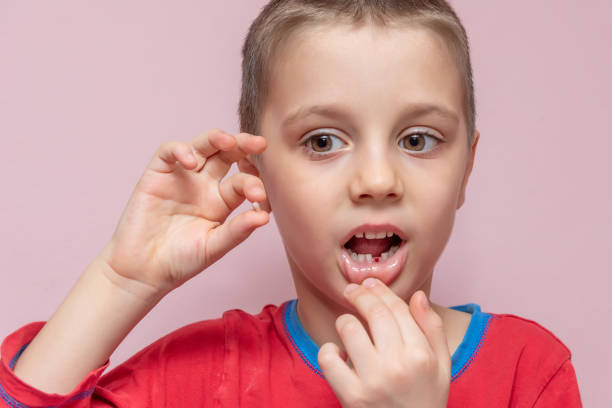istock Cute elementary age boy is pulled his baby tooth with hand himself. He is holding the dropped tooth and showing the tooth's place in his mouth. Tooth removal. 1302835192