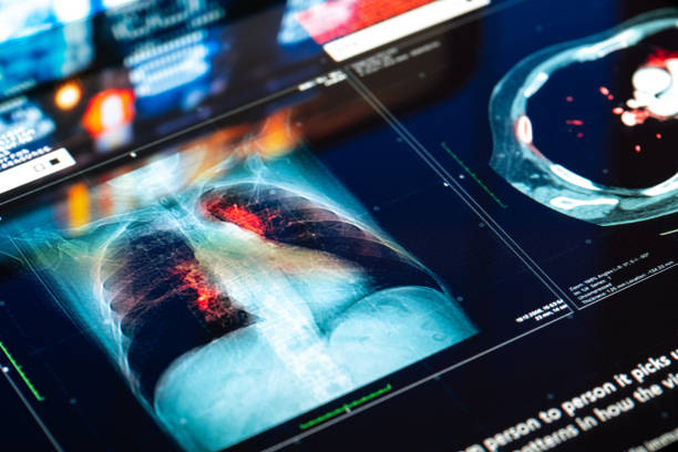 Medical MRI Scan Medical MRI Scan on digital screen digital xray stock pictures, royalty-free photos & images