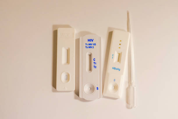 test hıv - test du sida photos et images de collection