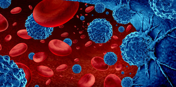 cancer dans le sang - blood cell photos et images de collection