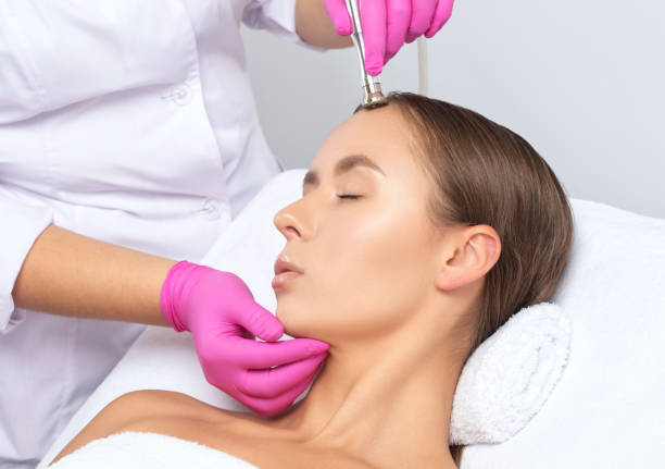 el cosmetólogo realiza el procedimiento microdermabrasión de la piel de la cara de una hermosa niña en un salón de belleza. cosmetología y cuidado profesional de la piel. - dermatology dermabrasion surgery medical fotografías e imágenes de stock