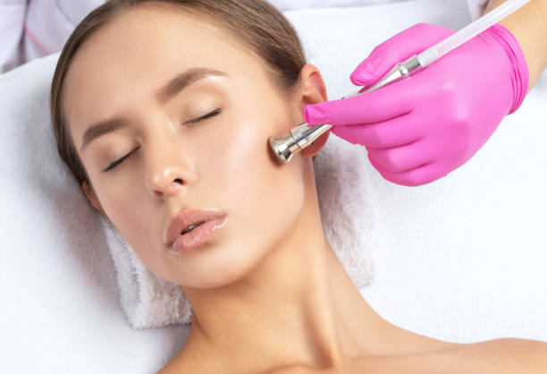 il cosmetologo fa la procedura microdermabrasion della pelle del viso di una bella ragazza in un salone di bellezza. cosmetologia e cura professionale della pelle. - dermatology dermabrasion surgery medical foto e immagini stock