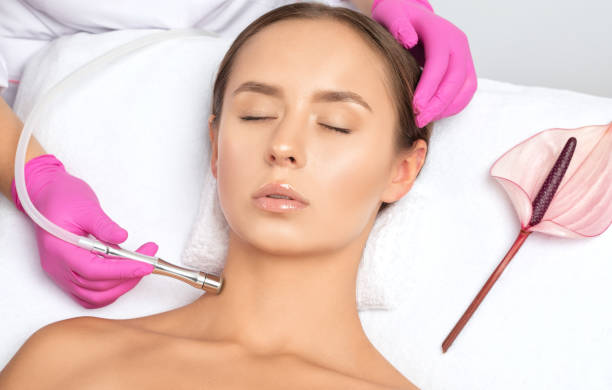 el cosmetólogo realiza el procedimiento microdermabrasión de la piel y el cuello de una hermosa niña en un salón de belleza. cosmetología y cuidado profesional de la piel. - dermatology dermabrasion surgery medical fotografías e imágenes de stock