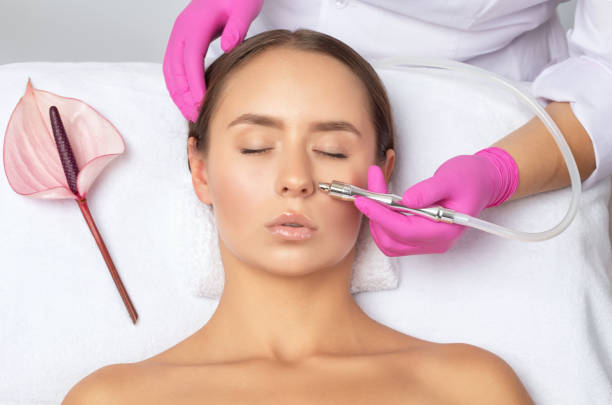 el cosmetólogo realiza el procedimiento microdermabrasión de la piel de la cara de una hermosa niña en un salón de belleza. cosmetología y cuidado profesional de la piel. - dermatology dermabrasion surgery medical fotografías e imágenes de stock