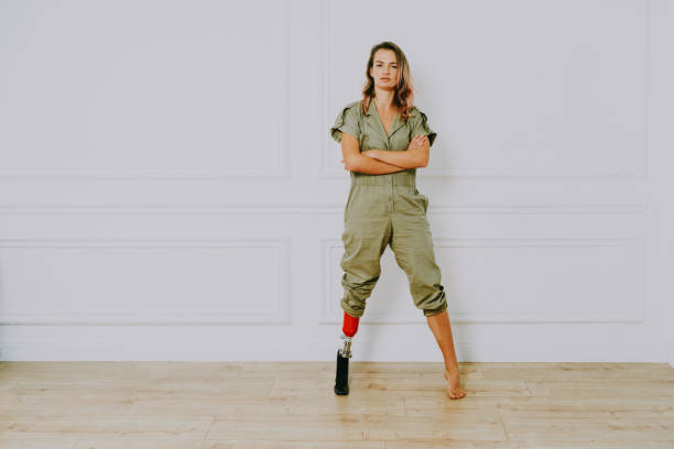 istock Beautiful woman with prosthesis leg 1303539081