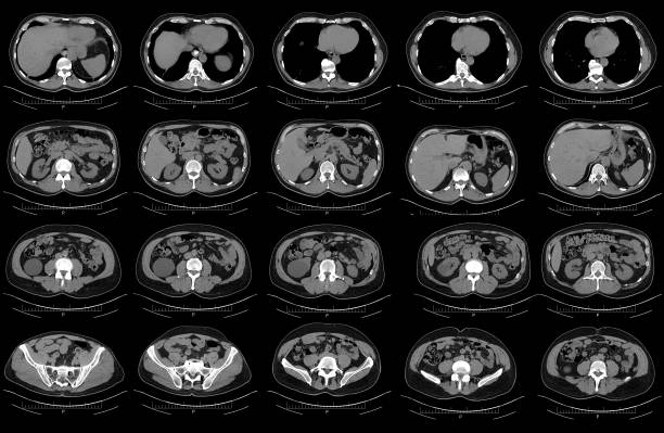 verificação superior do gato pélvis do abdômen - cat scan x ray medical scan x ray image - fotografias e filmes do acervo