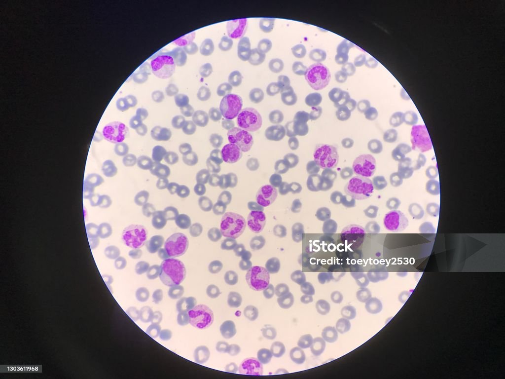 Segmented Neutrophil Segmented Neutrophil