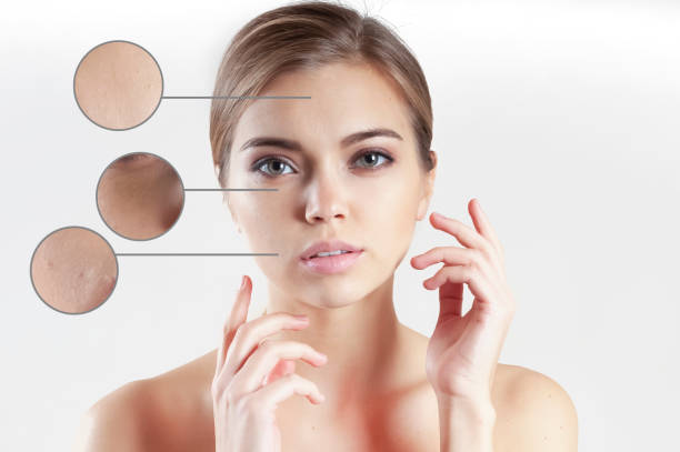 istock woman face wrinkles before and after treatment 1303661467