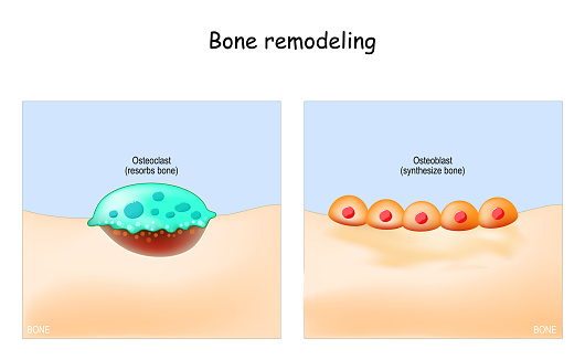 Bone remodeling. Close-up of a Osteoclast resorbs bone, and Osteoblasts synthesized bone tissue. Vector illustration