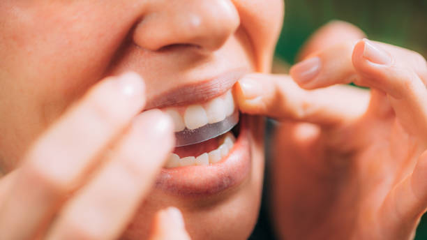 mujer usando estipes blanqueamiento o tiras blancas. blanqueando dientes en casa. - blanqueamiento dental fotografías e imágenes de stock