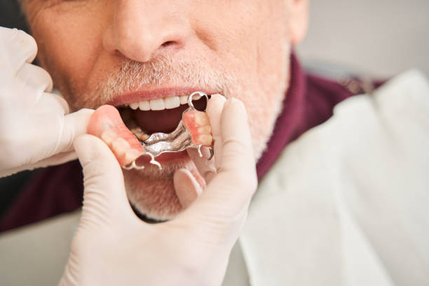 istock Dentist trying in denture to senior patient's mouth 1304246367