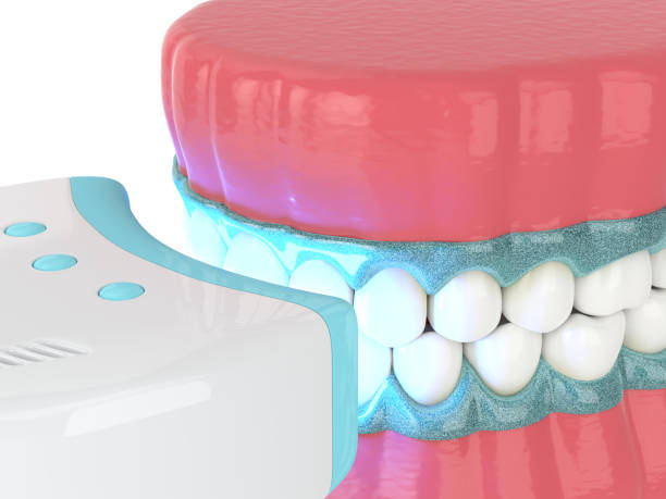 istock 3d render of jaw with teeth bleaching by uv lamp 1304250451
