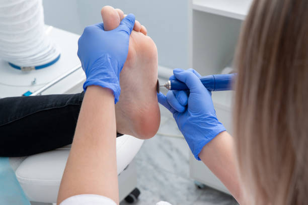 i chiropodisti rimuondono la pelle secca al tallone del piede di una donna - podiatrist pedicure human foot toenail foto e immagini stock