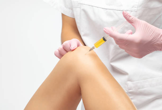 doctor doing stem cell therapy on a patient's knee after the injury. treating knee pain with platelet-rich plasma injection. treatment of arthritis and osteoarthritis.medical and cosmetology concept. - osteoarthritis doctor medicine healthcare and medicine imagens e fotografias de stock