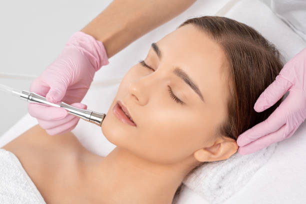 il cosmetologo fa la procedura microdermabrasion della pelle del viso di una bella ragazza in un salone di bellezza. cosmetologia e cura professionale della pelle. - dermatology dermabrasion surgery medical foto e immagini stock