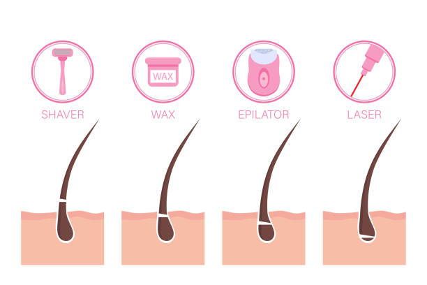 istock Diagram with type of epilation and hair removal methods 1304988800