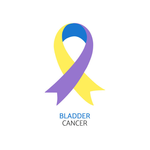 Bladder cancer awareness. Realistic Blue, marigold, and purple ribbon. Vector illustration. bladder cancer stock illustrations