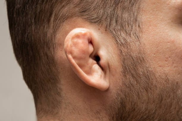 Damaged and broken cartilage of ear. Most famous injury for wrestlers and fighters. Photography of damaged ear. Ear of Fighters or Wrestlers. wrestlers uniform stock pictures, royalty-free photos & images