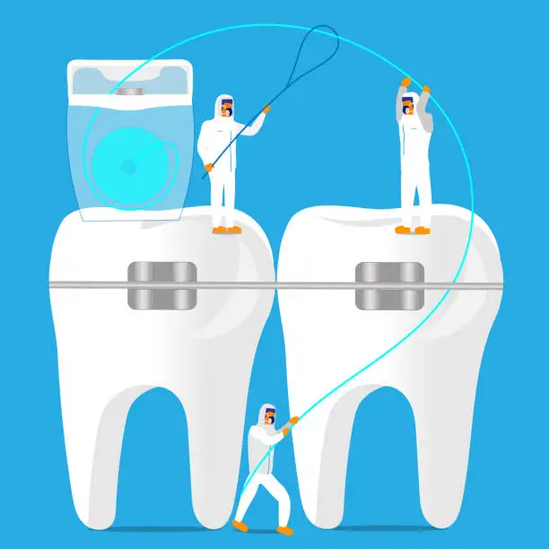 Vector illustration of Flossing between braces