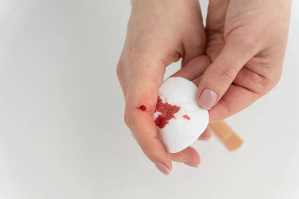 widok z góry rannego palca kobiety z kroplą krwi z powodu wypadku, r - wound blood human finger physical injury zdjęcia i obrazy z banku zdjęć