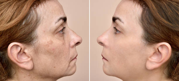 mujer antes y después de aplicar maquillaje y quitar bolsas de ojos - dot gain fotos fotografías e imágenes de stock