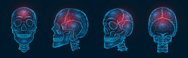 ilustrações de stock, clip art, desenhos animados e ícones de pain, injury or inflammation of the skull bones polygonal vector illustration. low poly model of a human skull - frontal lobe