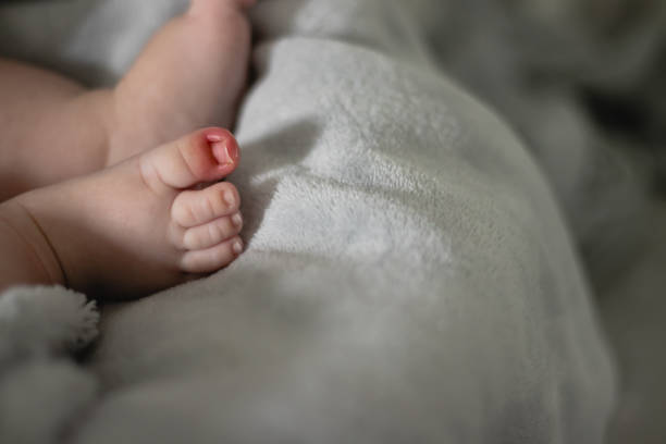 nahaufnahme blick auf den wachsenden nagel auf der baby-zehen mit anzeichen von entzündung - baby toe stock-fotos und bilder