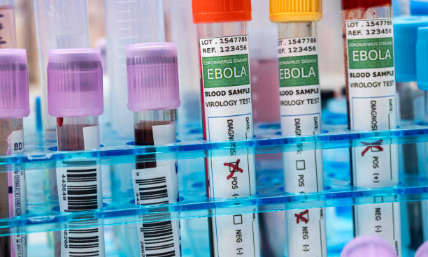 campione di sangue da paziente ebola, risultato positivo, immagine concettuale - ebola foto e immagini stock