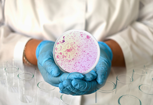 a girl in a medical gown and gloves holds a photo gonorrhea Neisseria gonorrhoeae from a microscope in a round frame.