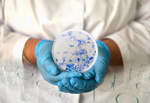 a girl in a medical gown and gloves holds a photo of Trichomonas from a microscope in a round frame.
