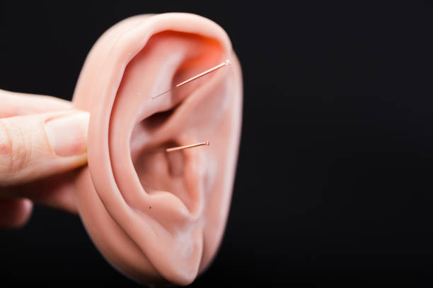 istock Acupuncture of ear 1305685266