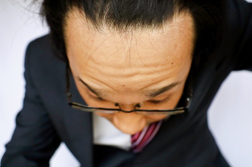 This is an image of a Japanese businessman with a bald forehead.