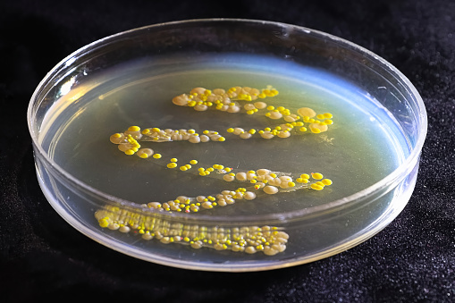 A petri dish with common yeast and bacteria colonies.