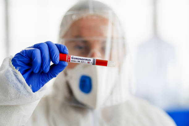 istock Covid-19 Blood Sample on lab background 1305907112