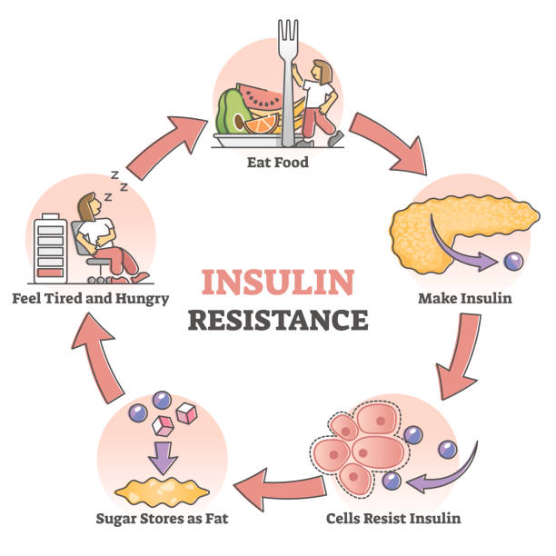 Insulin resistance pathological health condition educational outline diagram Insulin resistance pathological health condition in educational outline diagram. Labeled cycle scheme with anatomical explanation of process vector illustration. Medical state with high food demand. metabolism illustrations stock illustrations