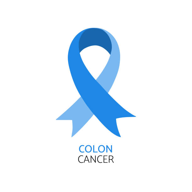 Colon cancer awareness symbol. Blue vector illustration. colon cancer screening stock illustrations