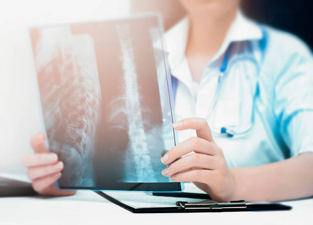 istock doctor with x-ray in his hands 1305980231