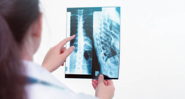 istock x-ray in the hands of a doctor 1305980290