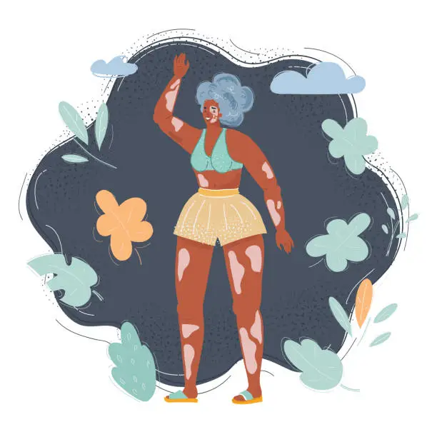 Vector illustration of Cartoon illustration of young happy woman with vitiligo skin, pigmentation on arms and legs wearing swimsuit on dark background.