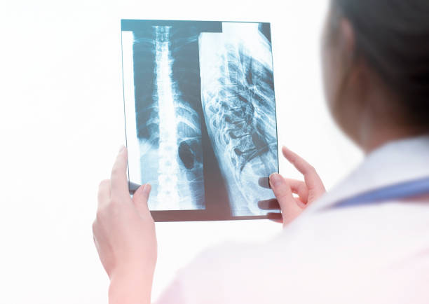 istock female doctor examines x-ray 1306266116