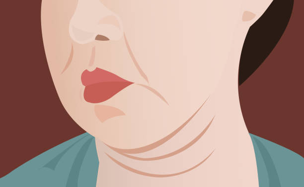 61 Cartoon Of A Double Chin Illustrations & Clip Art - iStock 61 Cartoon Of A Double Chin Illustrations & Clip Art - iStock